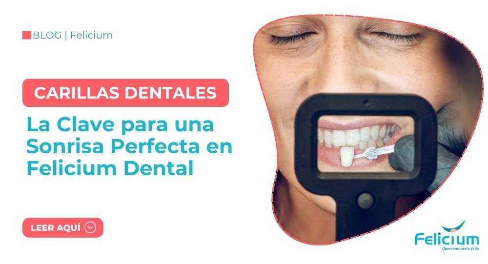 Carillas Dentales: La Clave para una Sonrisa Perfecta en Felicium Dental