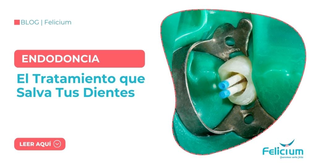 Endodoncia en Juliaca | Puno: El Tratamiento que Salva Tus Dientes