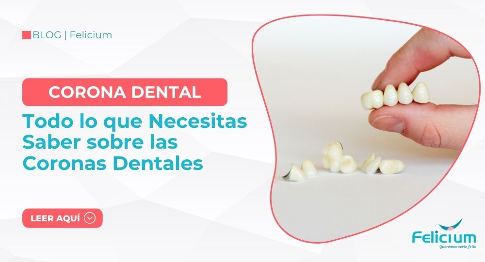 Todo lo que Necesitas Saber sobre las Coronas Dentales: Mejora tu Sonrisa con Felicium Dental