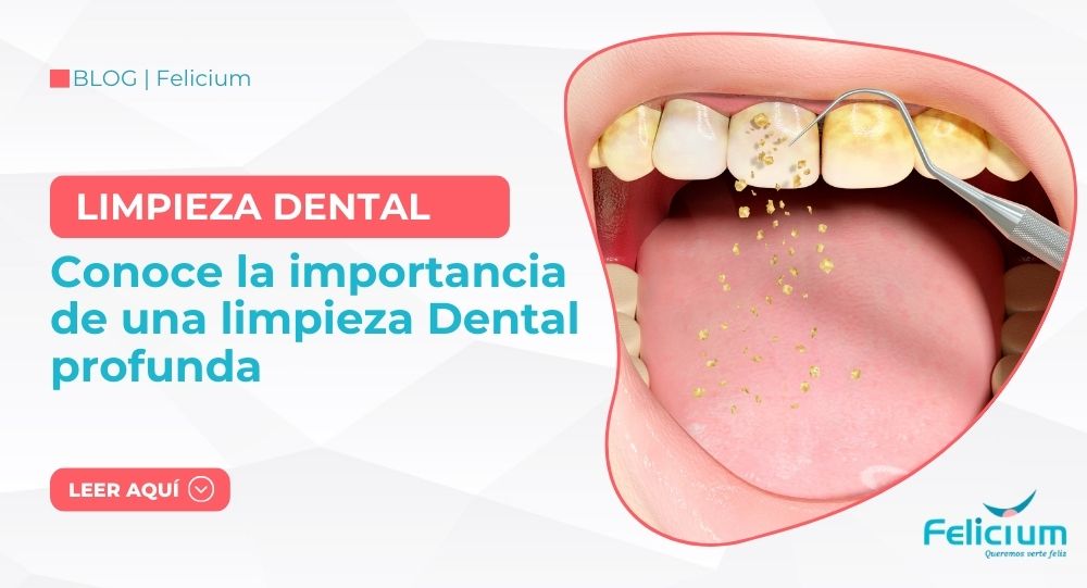 La Importancia de una Limpieza Dental Profesional : Cuida tu Sonrisa con Felicium en Juliaca y Puno