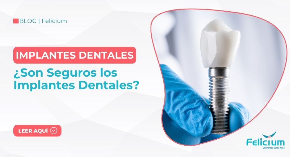 ¿Son Seguros los Implantes Dentales? Descúbrelo con Felicium Dental