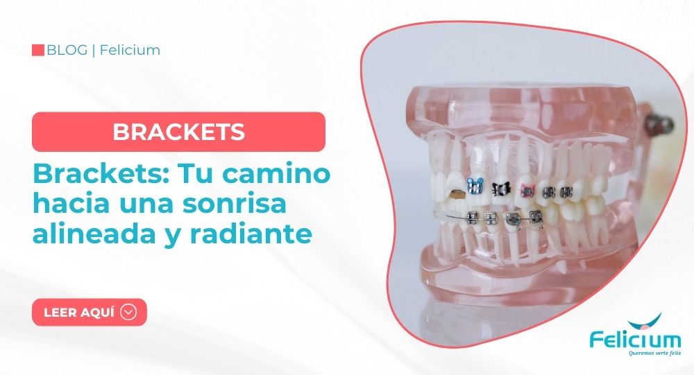 Brackets: Tu camino hacia una sonrisa alineada y radiante