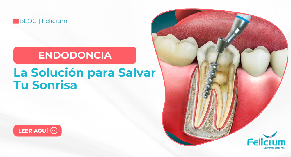 Endodoncia: La Solución para Salvar Tu Sonrisa en Juliaca – Puno